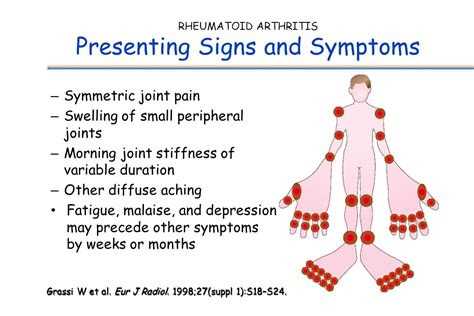 Swollen Lymph Nodes Rheumatoid Arthritis Are Your Swollen Glands A