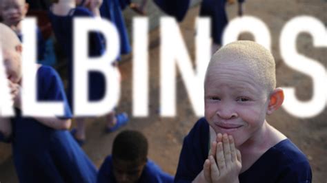 Albinos En Frica La Caza De Los Albinos En Frica