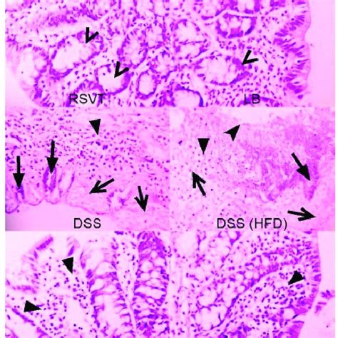 Photomicrographs Of Colon Specimens Showing Caspase 1 Immunoexpression Download Scientific