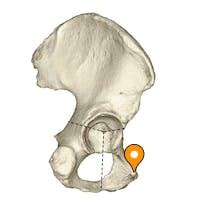 Pubic tubercle - e-Anatomy - IMAIOS