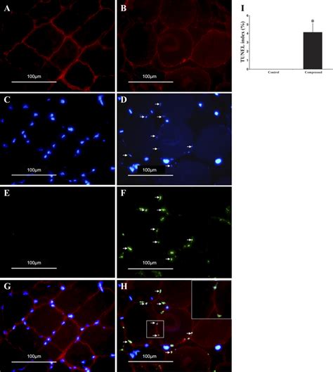 Terminal Dutp Nick End Labeling Tunel And Dystrophin Staining For