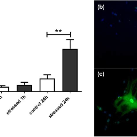 Oxidative Stress Induces MT I II Expression In Human Astrocytes A