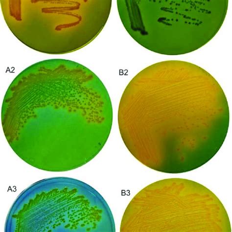 Growth Responses Of V Cholerae Strain N16961 And V Cholerae Strain