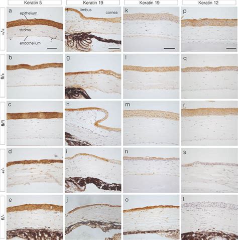 keratin     immunohistochemistry  corneal epithelia
