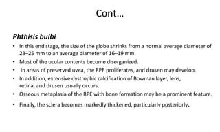 Phthisis Bulbi Ophthalmology Presentation Pptx