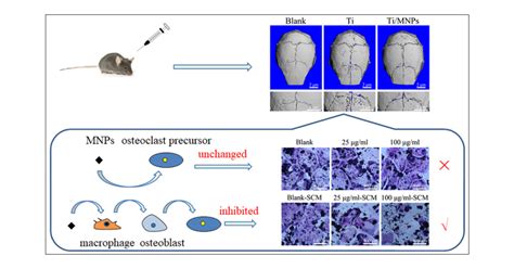 Mgo Nanoparticles Protect Against Titanium Particle Induced Osteolysis