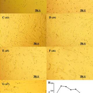 Morphological Characteristics And Growth Curve Of Theca Cells