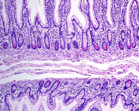 Small Intestine Paneth Cells Light Bild Kaufen Science