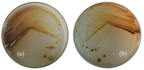 Streptomyces W 5B Cultivated In Starch Casein Nitrate Agar A Top