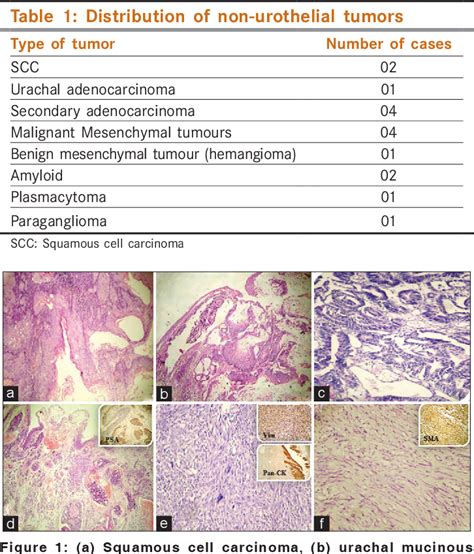 Table From A Clinicopathological And Immunohistochemical Study Of Non