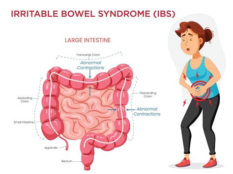 irritable bowel syndrome visualizing symptoms   intestine diagram