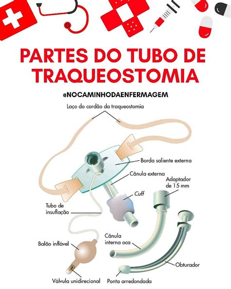 O'que É Traqueostomia - Etapas Do Procedimento De Traqueostomia RESUMO PROCEDIMENTOS