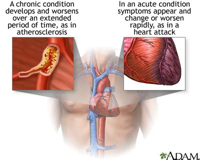 what is acute disease Acute diseases - Diseases Club center