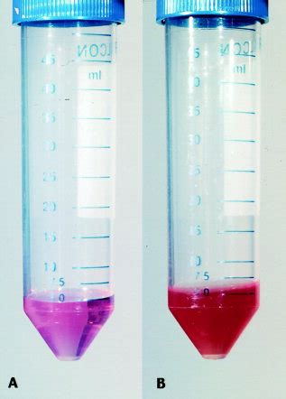 Rpmi Cell Culture Medium Before A And After B Vortex Disaggregation