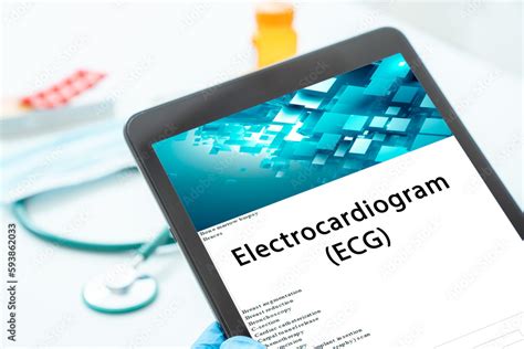 Electrocardiogram (ECG) medical procedures A procedure that records the electrical activity of ...