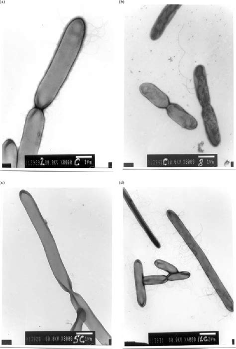 Transmission electron microscope (TEM) observations. The pictures show ...