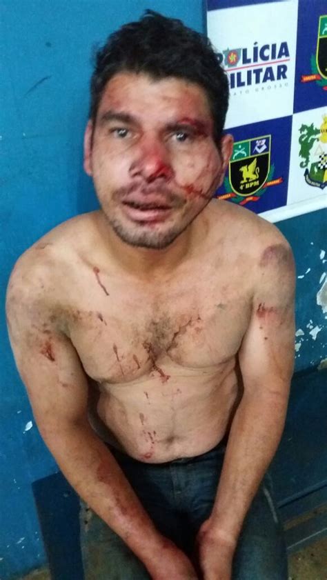 Marido é Amarrado Em Pilar E Agredido Por Moradores Após Esfaquear