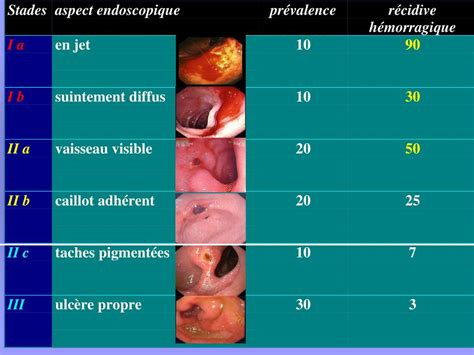 Gastric Ulcer Classification