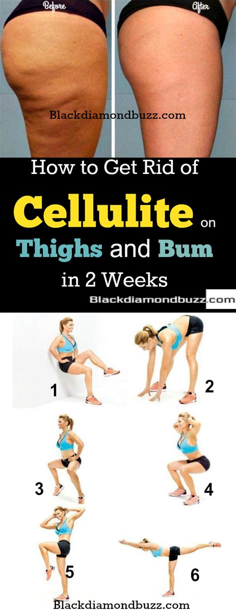 Best Exercise To Get Rid Of Leg Cellulite Online Degrees