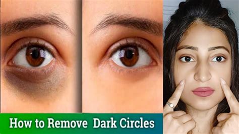 How To Get Rid Dark Circles And Puffy Eyes In Just 7 Days Home Remedy