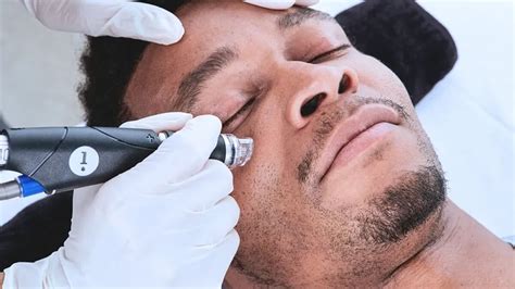 Is HydraFacial good for men? - Celebrity Laser & Skin Care