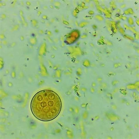 Entamoeba Coli Trofozoito