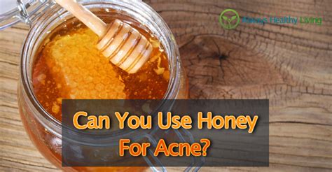 Can You Use Honey For Acne Treatment? - Always Healthy Living