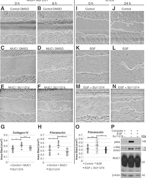 C Met Kinase Inhibitor SU11274 Inhibits MUC1 Dependent In Vitro