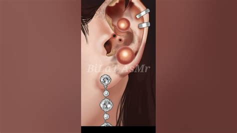 Asmr Ear Piercing Pus Removal Animation Asmr Shorts Youtube