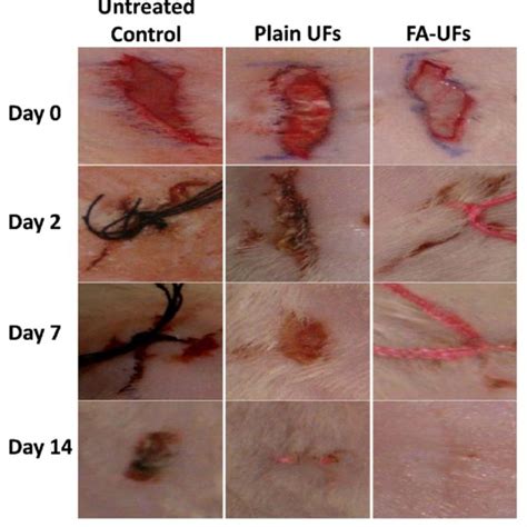 Effect Of Plain And Fusidic Acid Loaded Plga Ultrafine Fibers On The