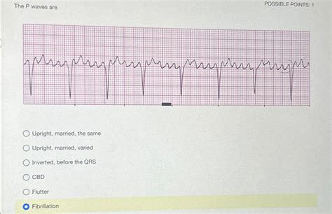 Solved The P ﻿waves areUpright, married, the sameUpright, | Chegg.com