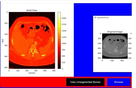 Github Hussfekrymediscan 3d Advanced Dicom Visualization Platform