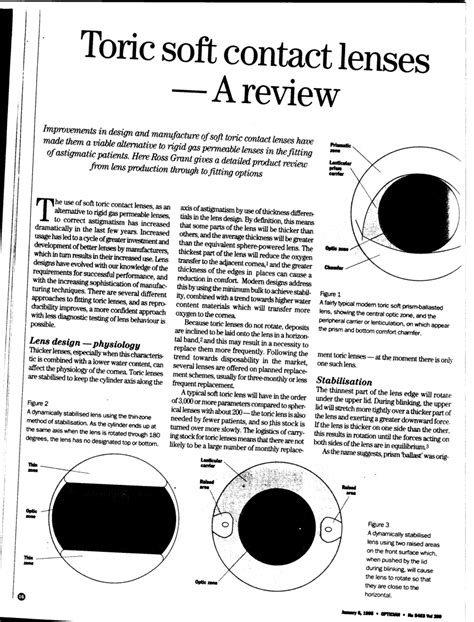 (PDF) Toric soft contact lenses - a review