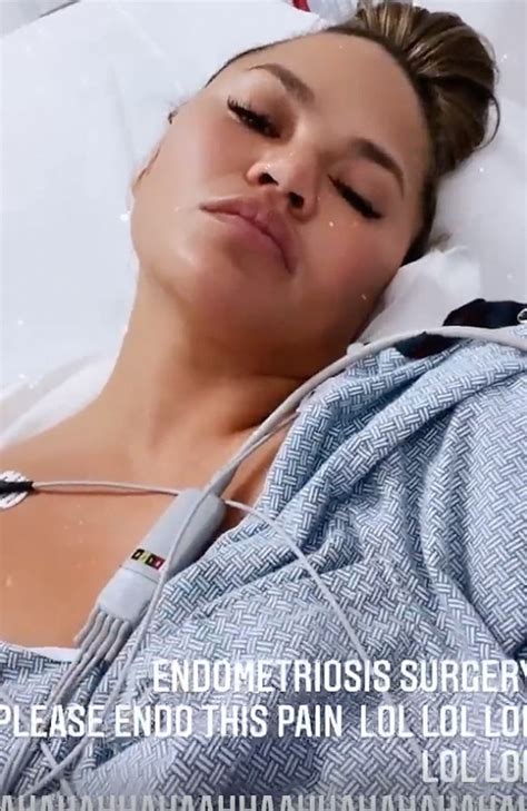 Chrissy Teigen Shares Instagram Photo Of Surgery Scars After Breast