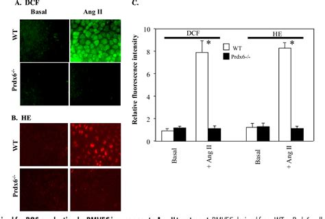 Figure 2 From Peroxiredoxin 6 Phosphorylation And Subsequent