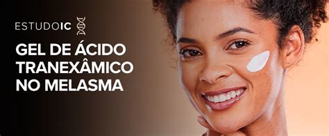 GEL DE ÁCIDO TRANEXÂMICO NO MELASMA ICosmetologia