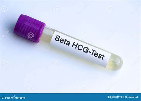 Urine Samples For Testing Hcg In The Laboratory Stock Image Image Of