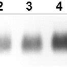 Effect Of The NO Donor Spermine NONOate On MT I MRNA Expression In