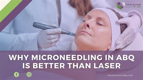 Microneedling vs Laser: Which Should You Go For in ABQ?