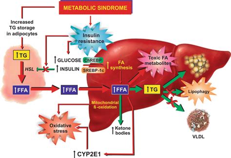 Metabolic Basis Of Nafld Pathogenesis Insulin Resistance Associated