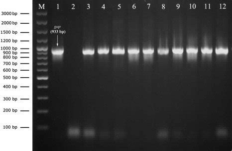 Agarose Gel Electrophoresis Of The PCR Product Of Gap Gene For DNA