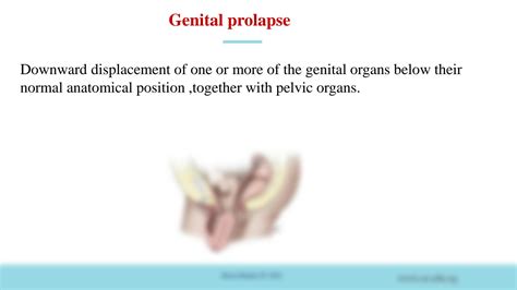 Solution Genital Prolapse And Fecal Incontinence Studypool