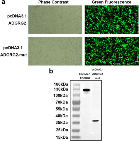 Expression Of Adgrg Protein In T Cells A Transfection Results Of