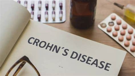 Us Fda Approves Omvoh For Severe Crohns Disease Relief All You Need