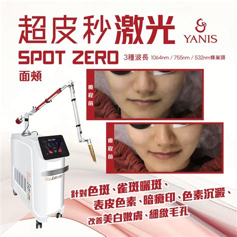 影響皮膚色素沉澱的成因，如何預防及淡化發炎後的色素沉澱？ Yanis Beauty・ Pico Extreme超皮秒美白嫩膚術，實現零死角白滑 ...