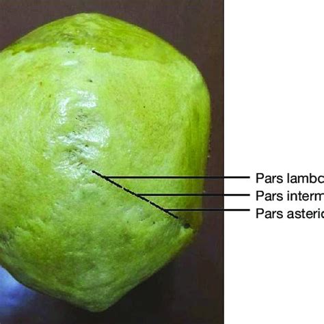Anatomic parts of lambdoid suture. | Download Scientific Diagram