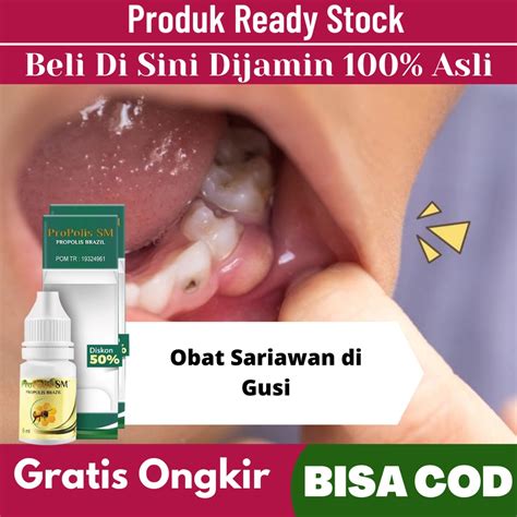 Jual Obat Sariawan Gusi Bengkak Obat Ulserasi Gusi Bengkak Luka Mulut