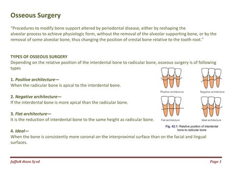 037. osseous surgery | PDF