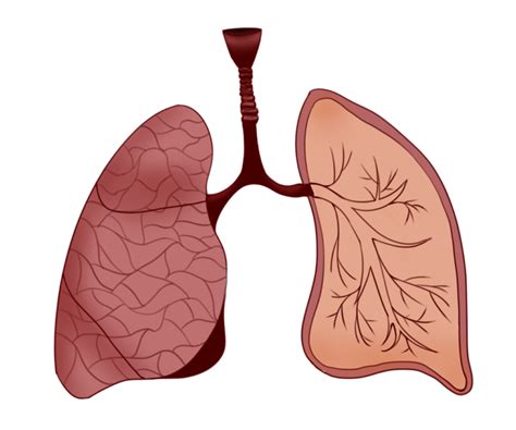 Płuca człowieka budowa i funkcjonowanie Transplantacja org pl