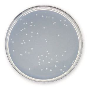 Plate Count Agar PCA Aerobios mesófilos Bioser